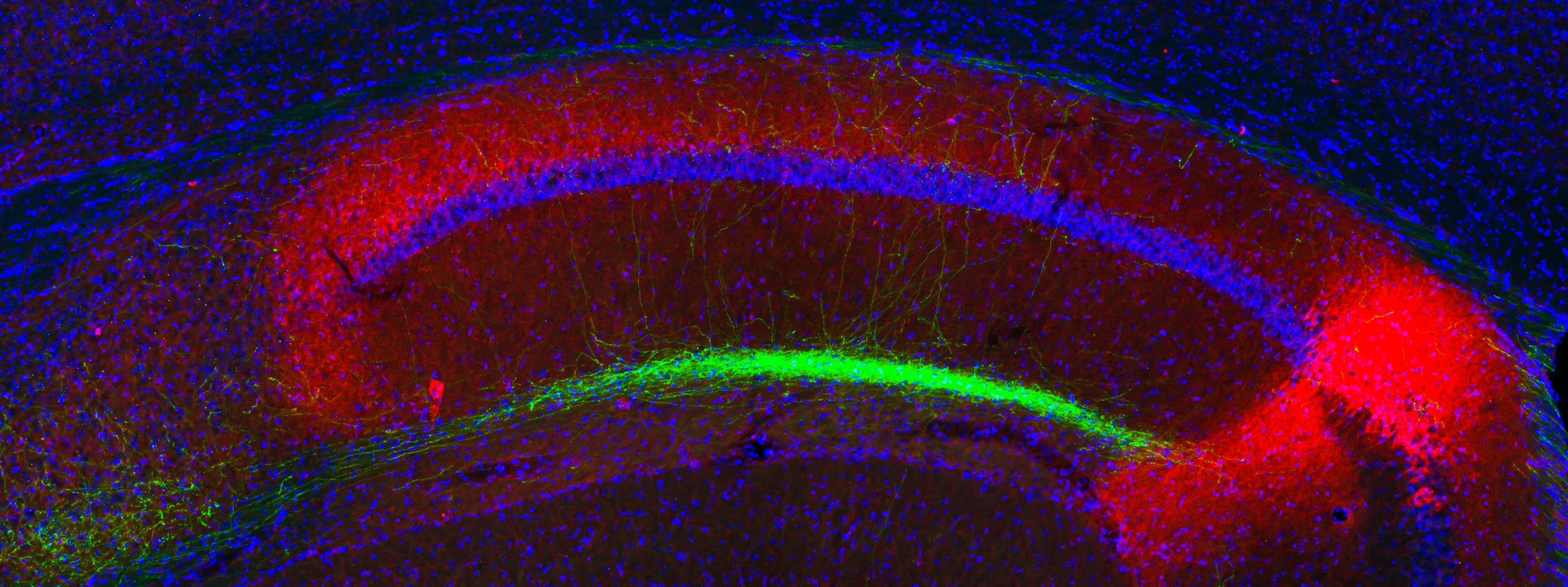 Our lab seeks to unravel the molecular, cellular and neural circuit mechanisms that underlie learning and memory...