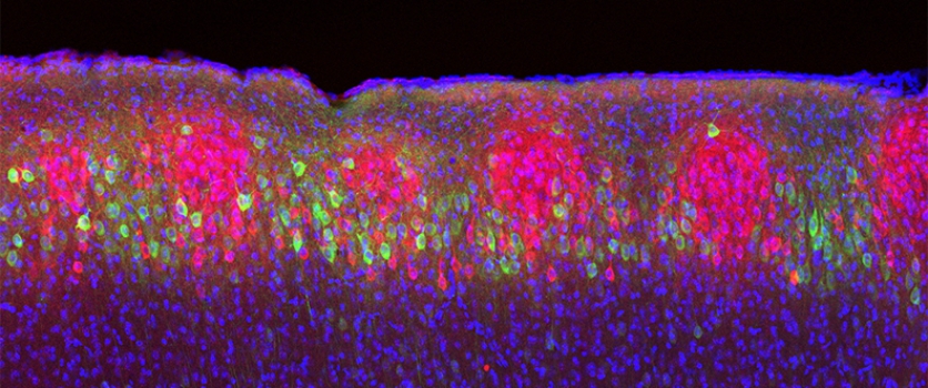 How the brain encodes time and place