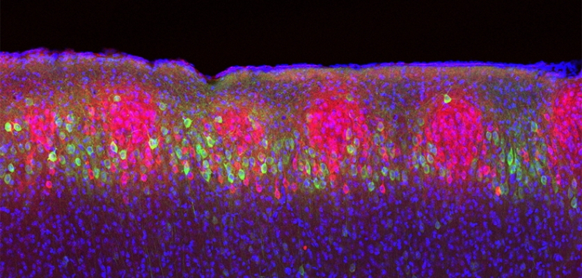 How the brain encodes time and place