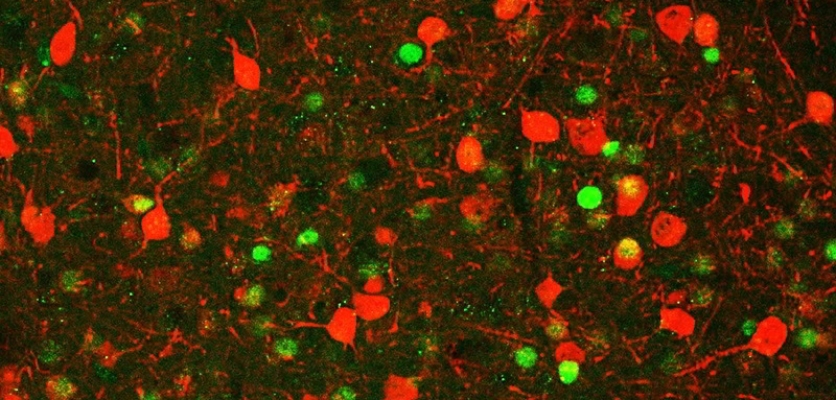 MIT neuroscientists build case for new theory of memory formation